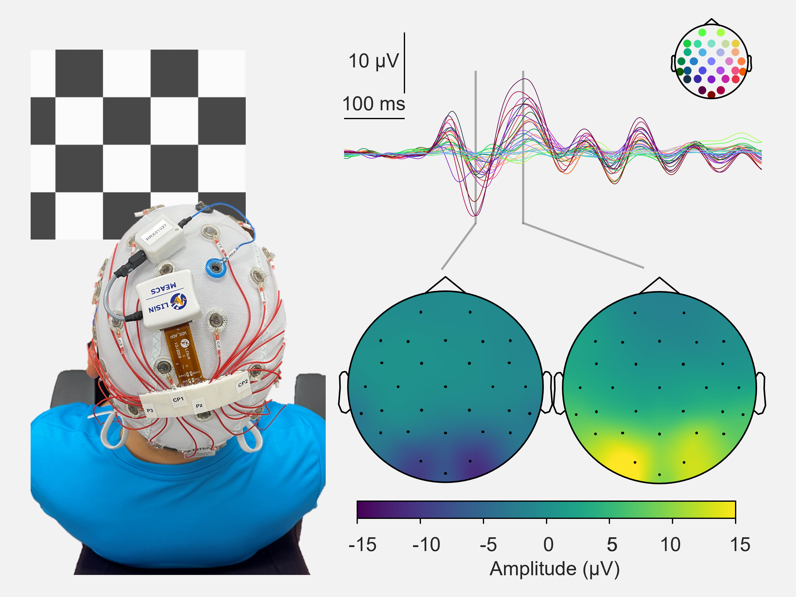 Applications in dynamic EEG