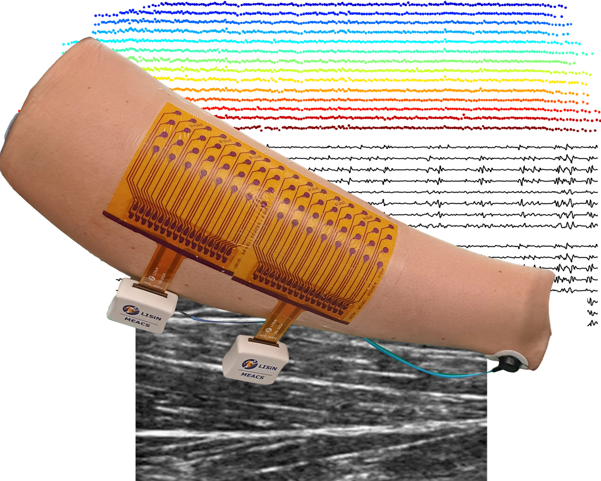 Applications to the sydy of muscle neuromechanics